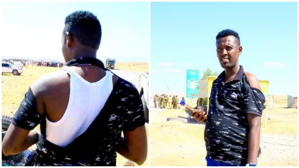 SBC TV journalist Yusuf Mohamud Yusuf pictured after he was assaulted by Bari Governor in Bosaso on 4 February 2021. | Photo/ Courtesy/ SJS.